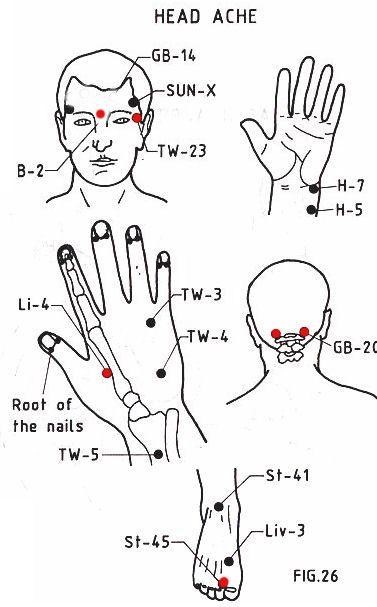 Headache relief roll on 2